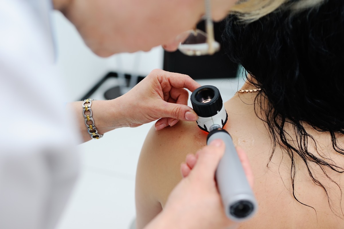 dermatologist inspecting a patient's skin